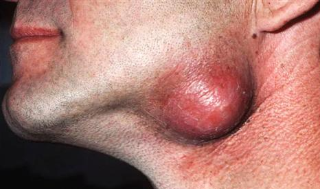 葛根加盟,戒檳榔項目,葛根品牌